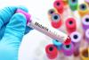 Burkina Faso closes Gates Foundation, Open Philanthropy funded malaria programme