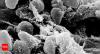 World’s first pandemic mystery solved: Scientists uncover Yersinia pestis through ancient DNA after 1,500 years