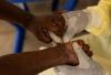Mpox cases rise: WHO warns of ongoing global health risk