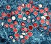 Mpox Progress Credited to Improved Diagnostics and Training