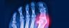 Science ScienceAlert Scientists Revive 20-Million-Year-Old Gene to Help Fight Gout