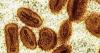 Mpox no longer an international health emergency: WHO