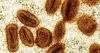 Mpox outbreak no longer a global health emergency, WHO chief says