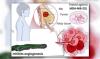 Hyderabad and Kolkata scientists develop smart metal agents to combat aggressive breast cancer