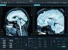 Scientists identify very specific ages when human brains lose cognitive control