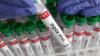 Mpox No Longer International Health Emergency: WHO 