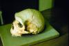 This strange skull has completely baffled scientists for 60 years – until now