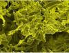 WHO publishes global statistics highlighting cholera outbreaks and deaths in 2024