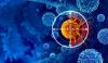 Kazakhstan Sees Growth in Urban Cancer Cases