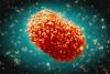 Three cases of Monkeypox diagnosed in Barbados