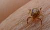 Karachi reports 5th Congo virus death of 2025