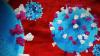 Measles case reported in Valencia County