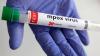 Africa CDC Reports Mpox Progress, DRC Hotspot