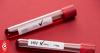 HIV 'national crisis' in Fiji - assistant health minister
