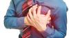 Expert links rising heart attacks to poor nutrition, lifestyle choices