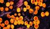 Kenya and Zambia battle mpox spikes as African countries manage multiple health threats