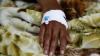 Cholera Crisis Escalates in Africa: Over 4,200 Dead, 190,000 Cases Reported in 2025, World Health Organization Warns