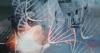 Spanish scientists hail breakthrough in Alzheimer’s treatment as debate grows over safety, costs, and benefits