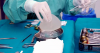 Loans and pawned gold- Iranians reveal cost of beauty surgeries