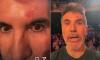 Simon Cowell returns to Britain's Got Talent with a painful injury as he reveals the 'real reason' behind his absence after throwing auditions into chaos
