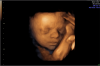Spain and Luxembourg Want a Right to Kill Babies in Abortions