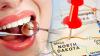 North Dakota Dental Insurance Overhaul: Stop “deny-and-no-bill” and Simplify Claims