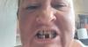 NHS worker refused treatment in UK flies to Croatia for new teeth
