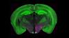 Scientists Uncover the Brain’s Hidden Pain Switch