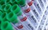 Dutch agriculture ministry orders farmers to keep chickens inside due to bird flu risk