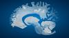Science ScienceAlert Male Brains Shrink Faster Than Female Brains, Study Finds