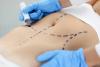 Why Bangkok is Becoming a Top Destination for Body Contouring Surgery