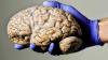 SCIENTISTS UNVEIL FIRST DRAFT OF DEVELOPING BRAIN ATLAS