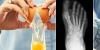 Osteoporosis: Eating eggs may halt disease thanks to bone-boosting compound, scientists discover