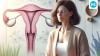 Apollo gynaecologist shares what women need to know about PCOS and menopause: ‘Lifestyle matters more than you think’