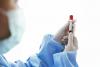 Prague Reports 37 New Hepatitis A Cases: Situation Slightly Stabilised