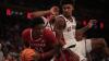 Alabama basketball center Collins Onyejiaka medical condition revealed
