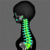Monte Carlo Analysis of Pediatric Spine Radiography Doses