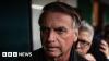 Brazil's Bolsonaro undergoes medical treatment for hiccups