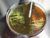 High superbug load in Delhi environment posing public health risks: Study