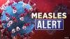 First case of Measles confirmed in Eastern Idaho for 2026