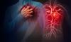 Air pollution linked to more severe heart disease,  reveals study