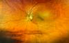 Manufacturing Science Matters in Biosimilar Retinal Biotherapeutics