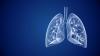 Scientists Uncover New Clues on Lung Cancer Treatment Resistance
