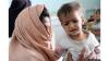 UNICEF Warns Acute Child Malnutrition Worsening Across Afghanistan