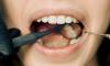 No more black fillings in Croatia under rules