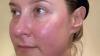 I hated my rosy pink skin so tried a £5 serum for a fortnight to see if it helped – the results left me stunned