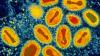 Deadly smallpox poised to help trigger ‘next pandemic’ that could strike at any moment, experts fear