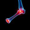Scientists Identify Key Molecular Trigger Behind Failed Healing of Certain Broken Bones