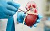 Scientists Create a Kidney That Can Be Transplanted to Anyone, Regardless of Blood Type