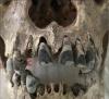 Cosmetic Tooth Blackening Dates Back 2,000 Years in Vietnam
